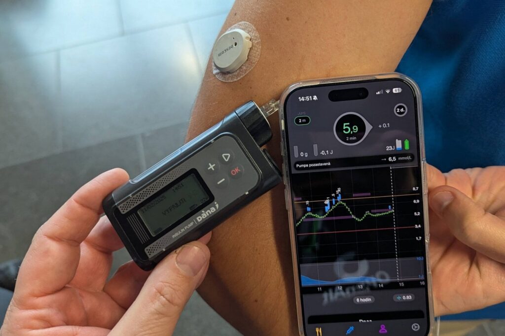 iAPS, Dana-I, Dexcom G7